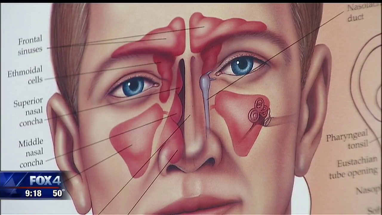 What to know about Cedar Fever