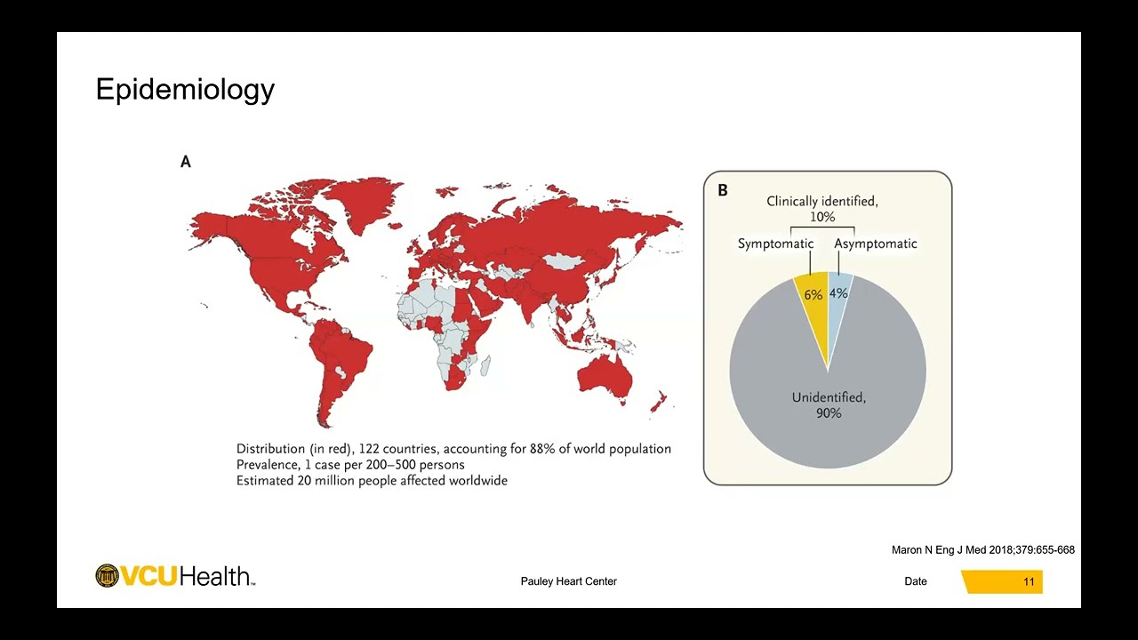 DOIM GR 10/19/23: Hypertrophic Cardiomyopathy