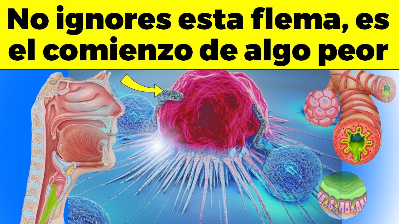 ¡El PELIGRO con la FLEMA PERSISTENTE, puedes ESTAR EN RIESGO DE ESTO