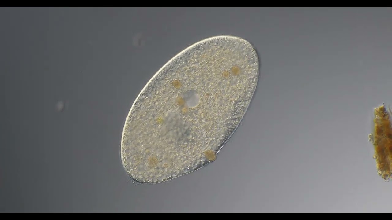 Ciliate frontonia 200x