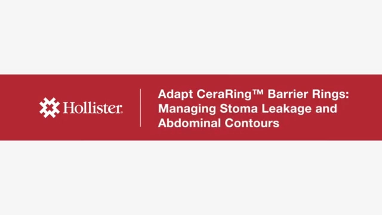Hollister Adapt CeraRing&trade; Flat Barrier Rings: Managing Stoma Leakage and Abdominal Contours