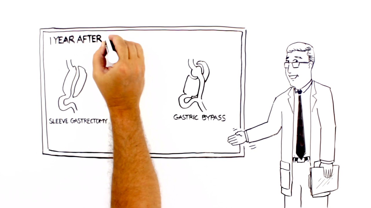 Don’t Believe the Myths  Learn the Truth about Bariatric Surgery