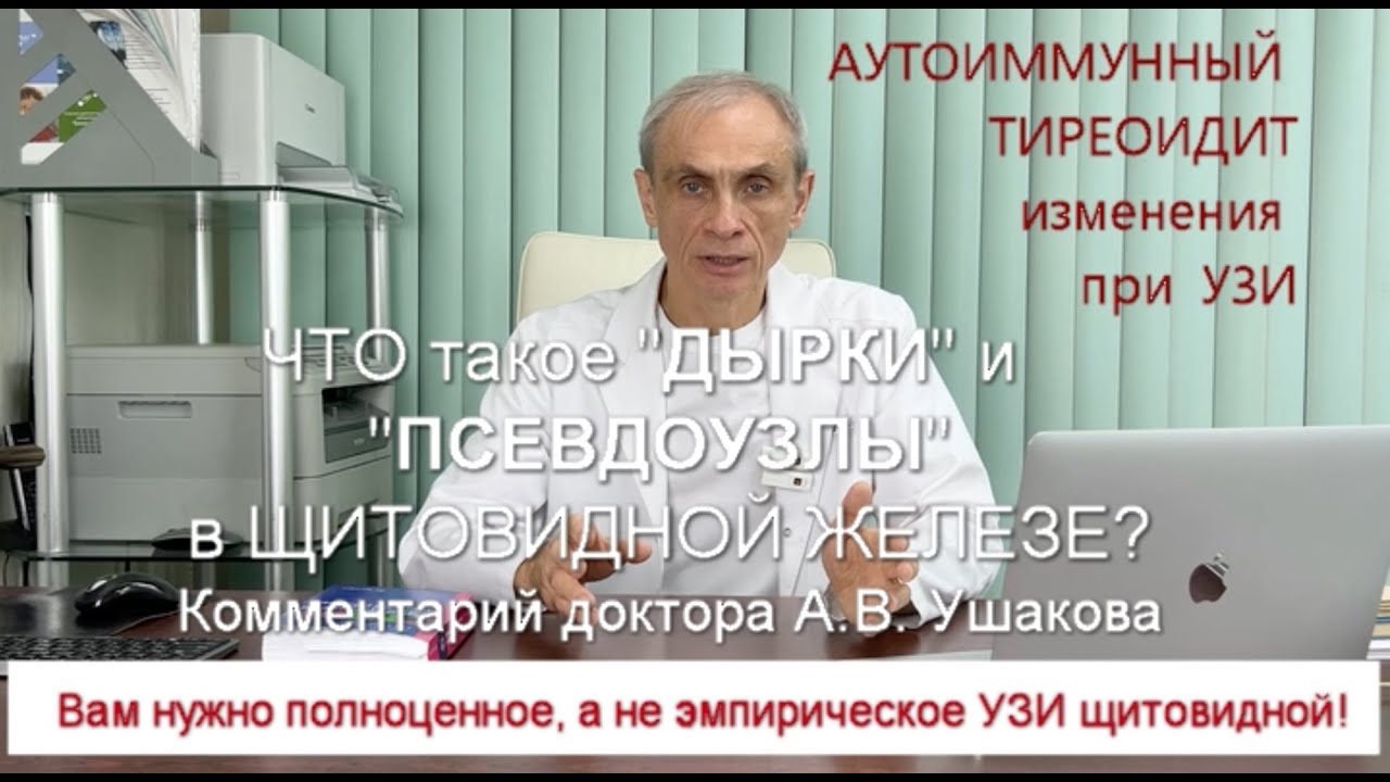 Что такое 