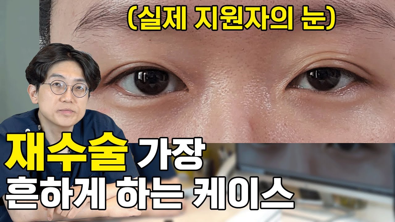 온라인상담) 재수술하는 가장 흔한 케이스 - 재수술 전에 보고 갈 영상
