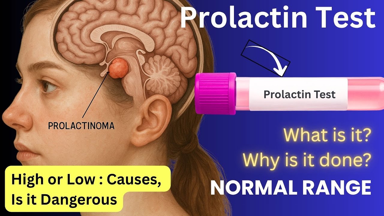 What is a Prolactin Test : Procedure, Symptoms, Normal Range, Price in India, Reasons for high level