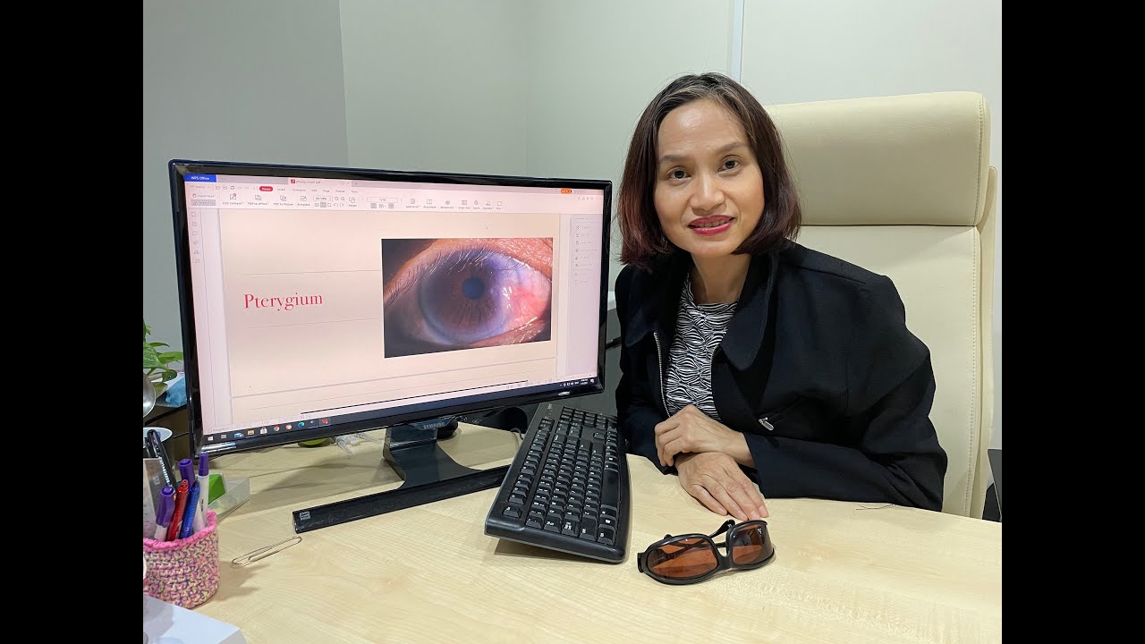 Pterygium demystified . Symptoms and causes.  When do we need to treat it?