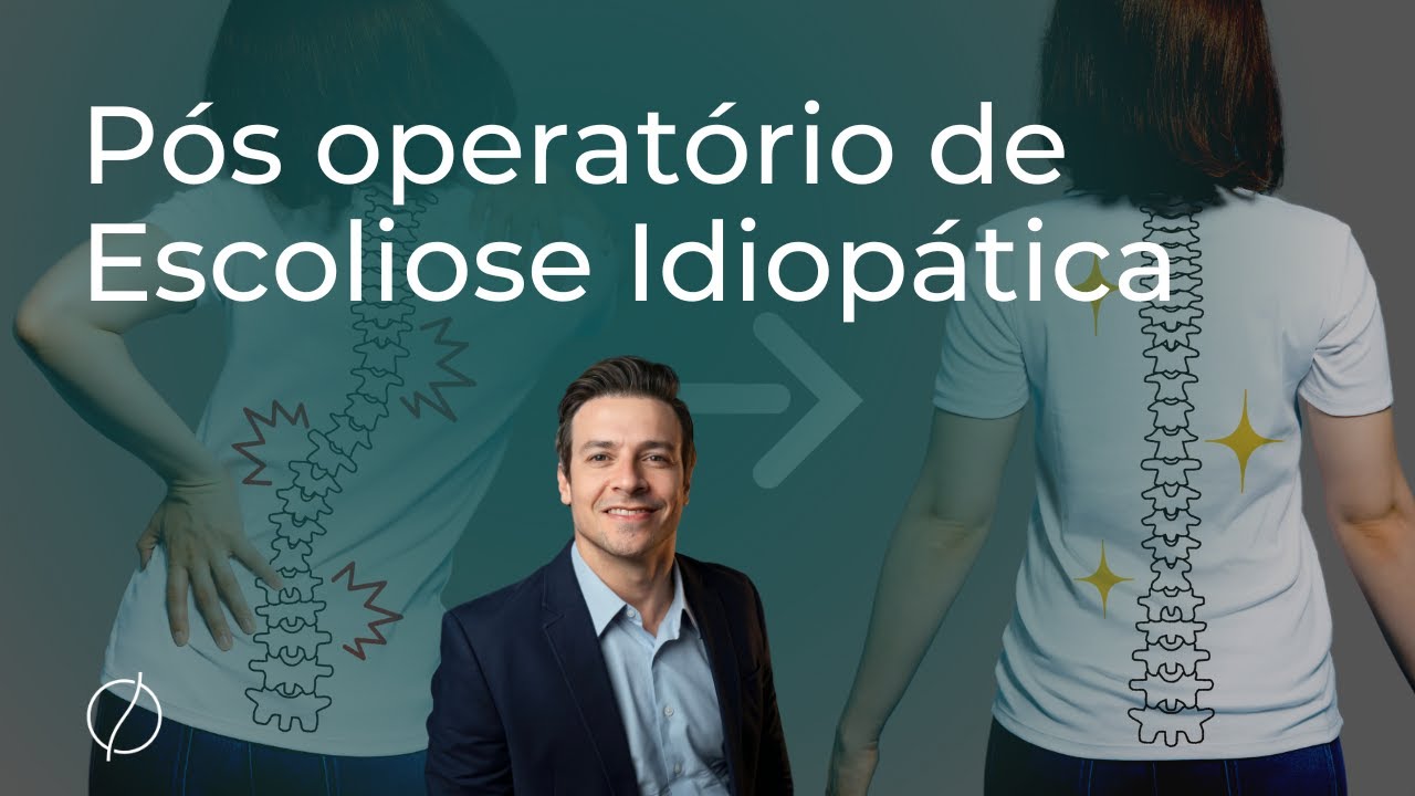 Pós operatório de Escoliose Idiopática: o que você precisa saber.
