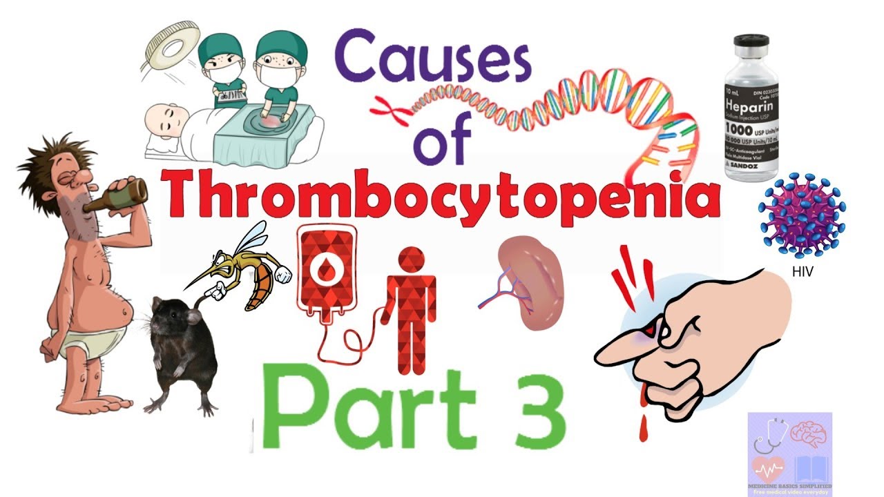 Thrombocytopenia causes-Interpretation of complete blood count part 2.4