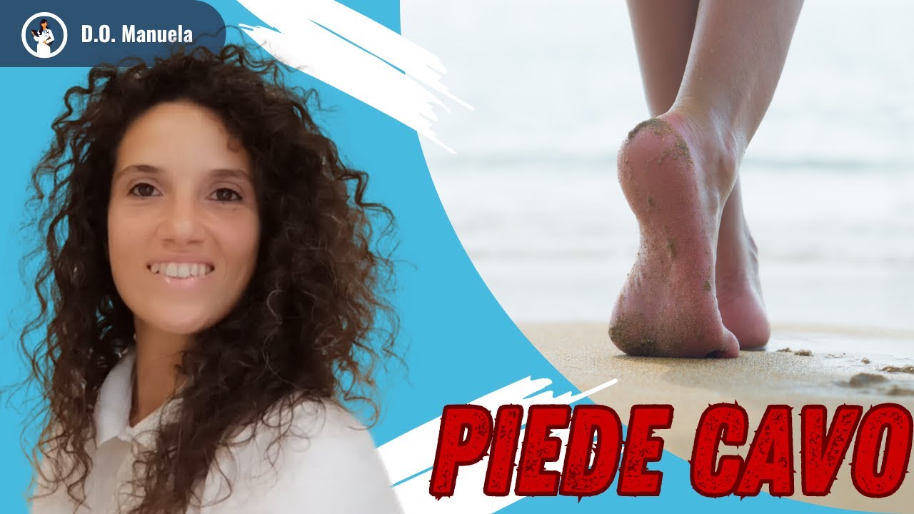 🔥PIEDE CAVO: come affrontarlo al meglio