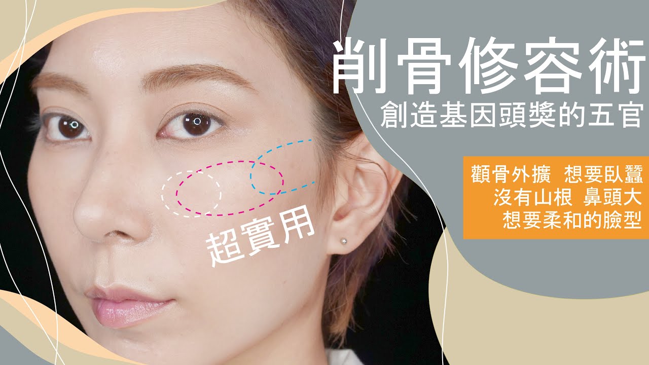 超實用《削骨修容術》為自己創造基因頭獎的五官/眼型/下顎線/縮顴骨/縮鼻頭/山根 #新手必看40｜Astor