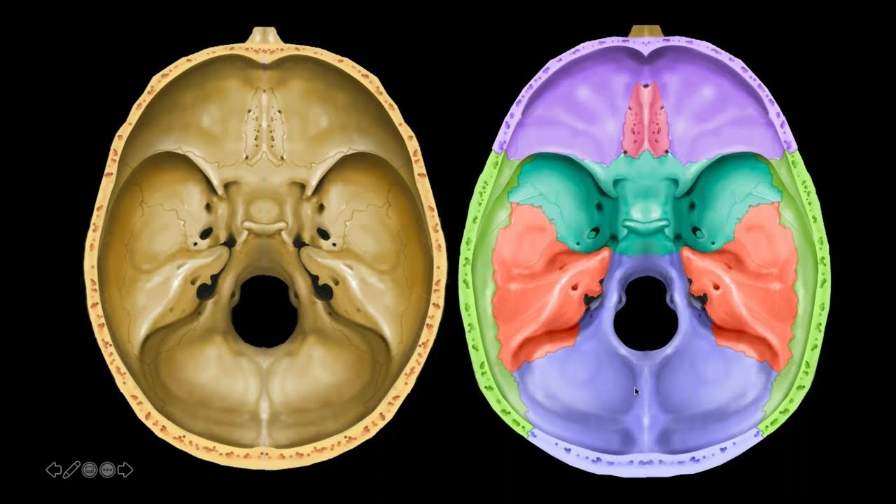 Temporal Bone Imaging Made 