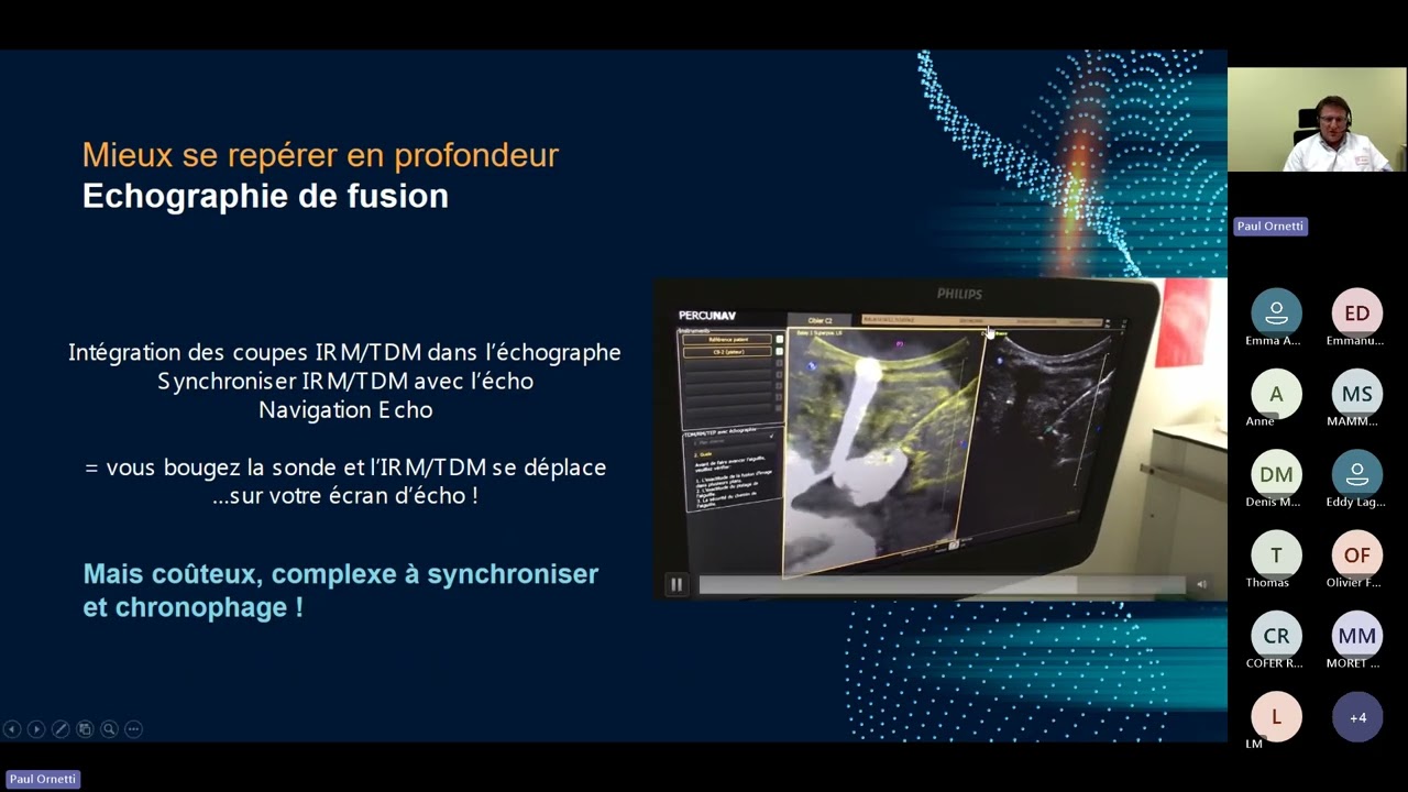 20250507 Quel futur pour l'échographie en rhumatologie