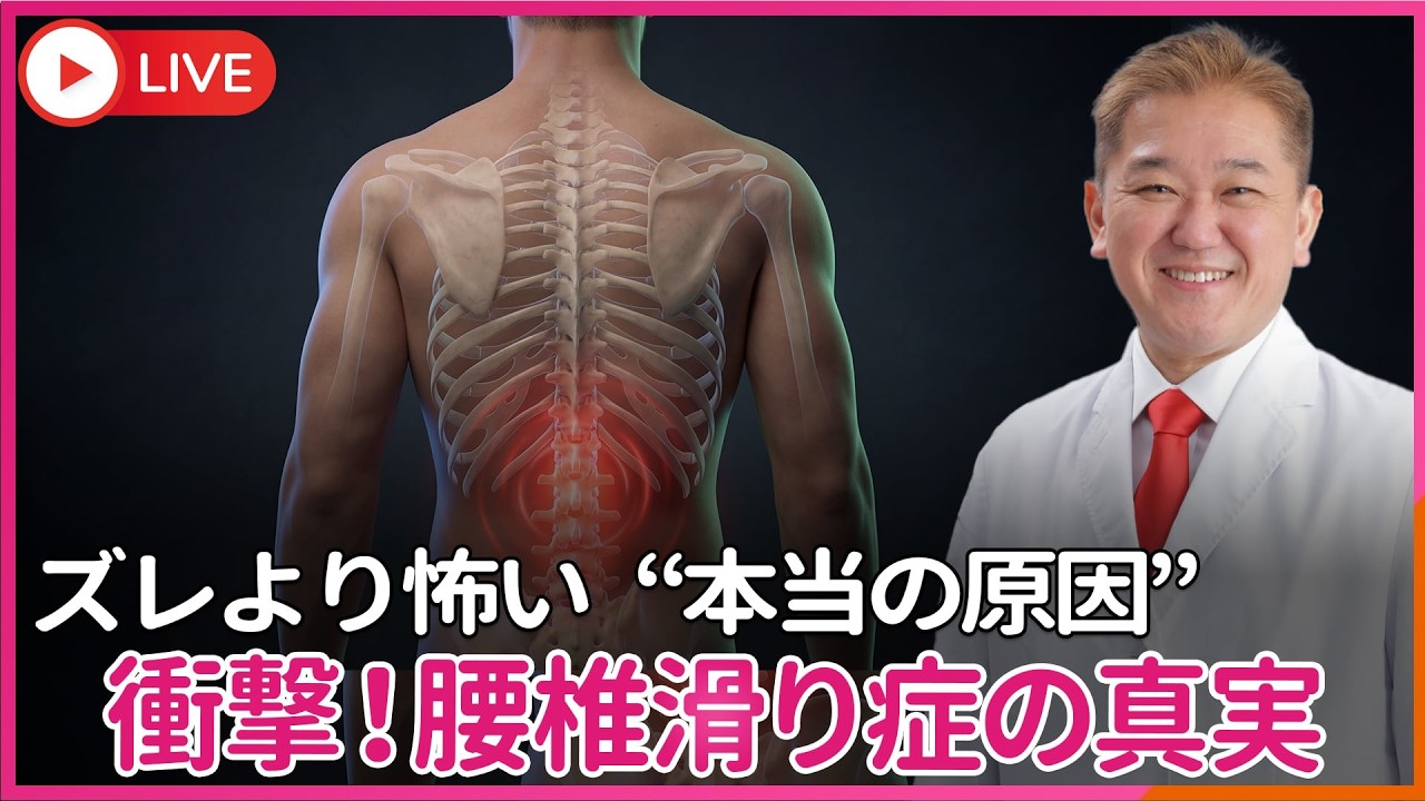 【衝撃】腰椎すべり症だから痛い？それ、間違いです  手術と言われた人へ…　ズレより怖い“本当の原因”