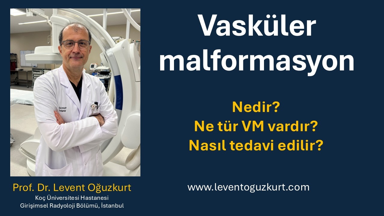 Vasküler Malformasyon