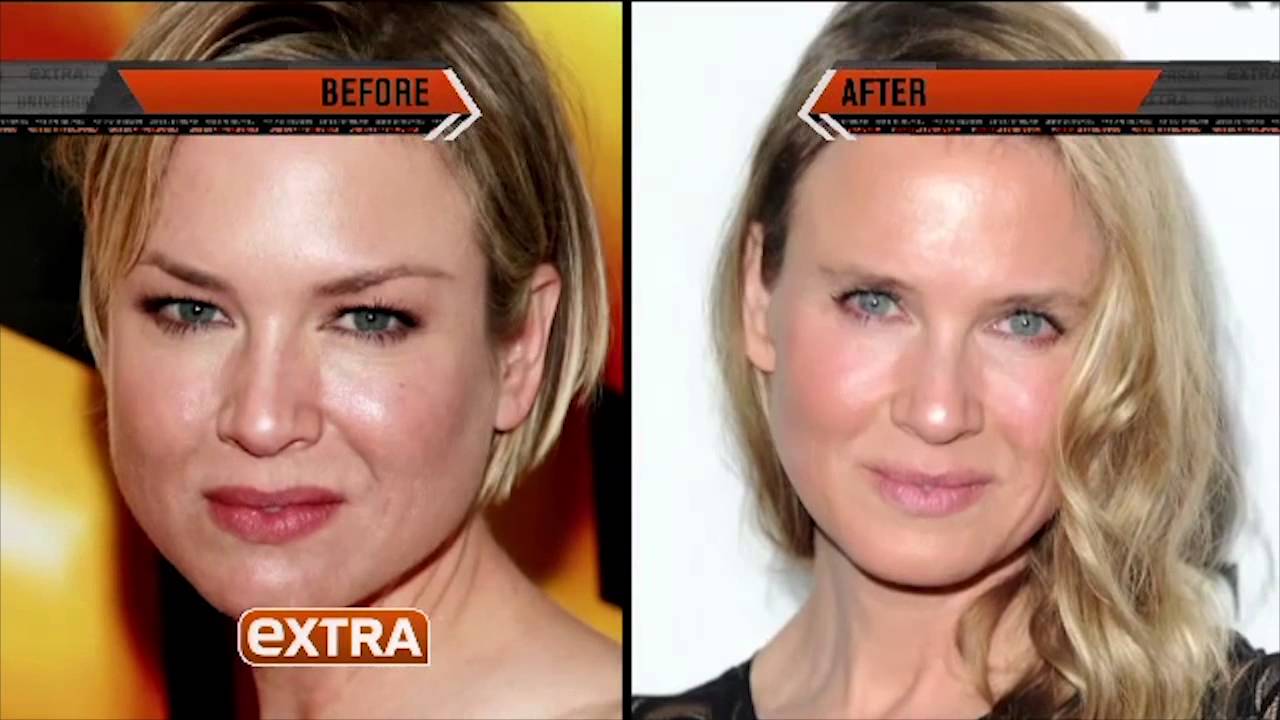 EXTRA - Renee Zellweger Controversy - Dr. Haworth of Beverly Hills