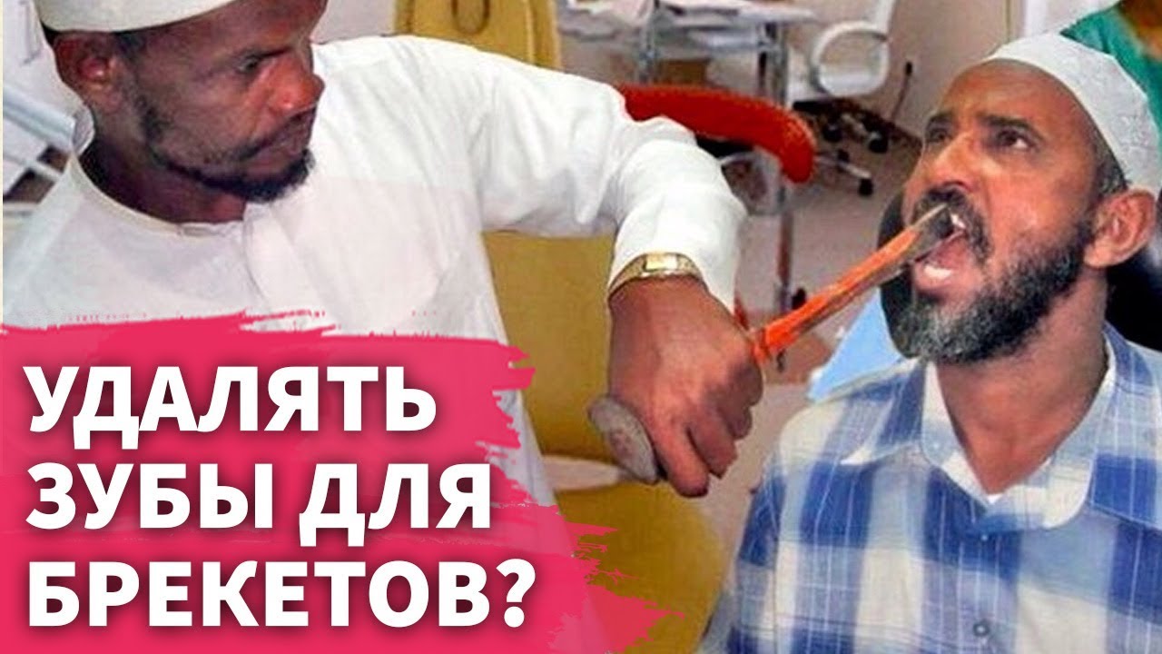 Удалять ли зубы мудрости или четверки для брекетов?