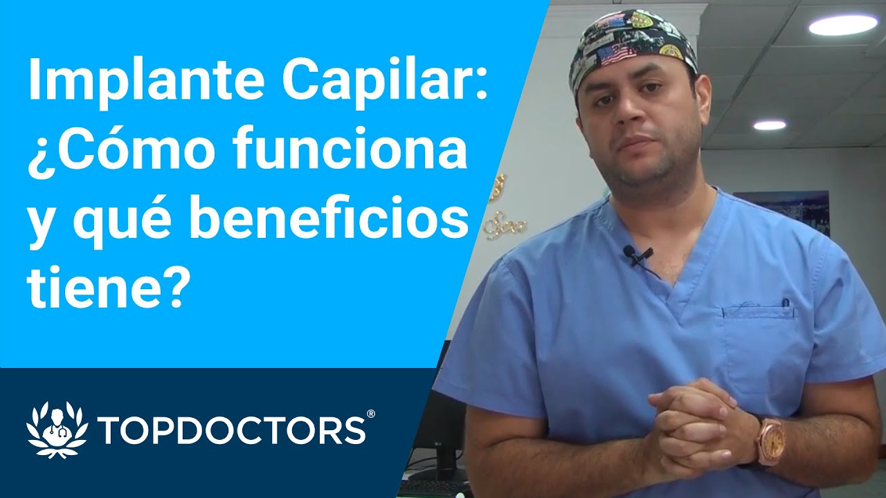 Implante Capilar: &iquest;C&oacute;mo funciona y qu&eacute; beneficios tiene?