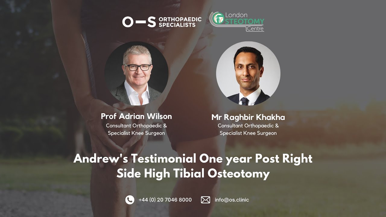 Andrew's Testimonial One Year Post Right Side | High Tibial Osteotomy | Orthopaedic Specialists