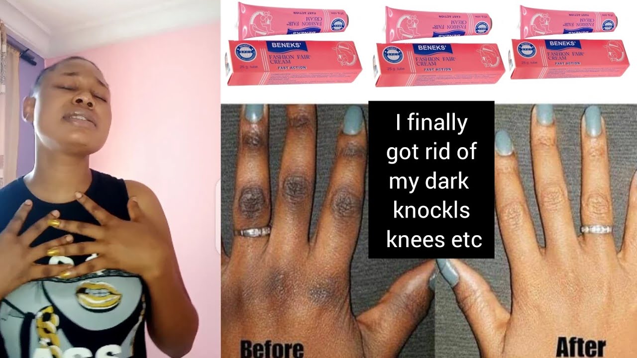 How I  Got Rid Of My Dark Knockls: Fashion Fair Tube Honest Review #darkknuckles #cleardarkspots