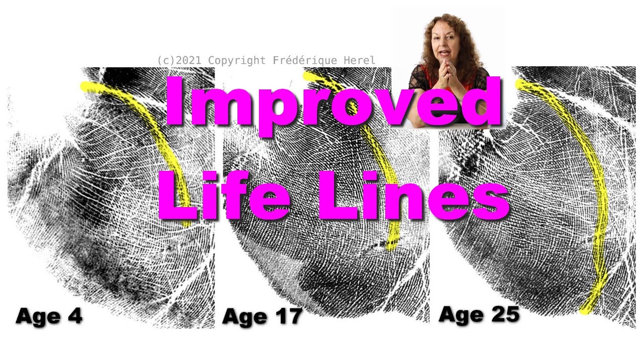 Improved Life Lines