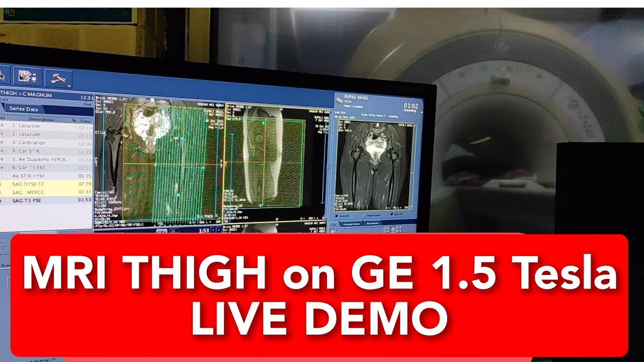Thigh MRI scan protocol, positioning and planning | Live Demo.