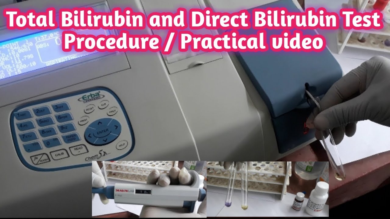 Total Bilirubin and Direct Bilirubin Test Procedure Practical Video