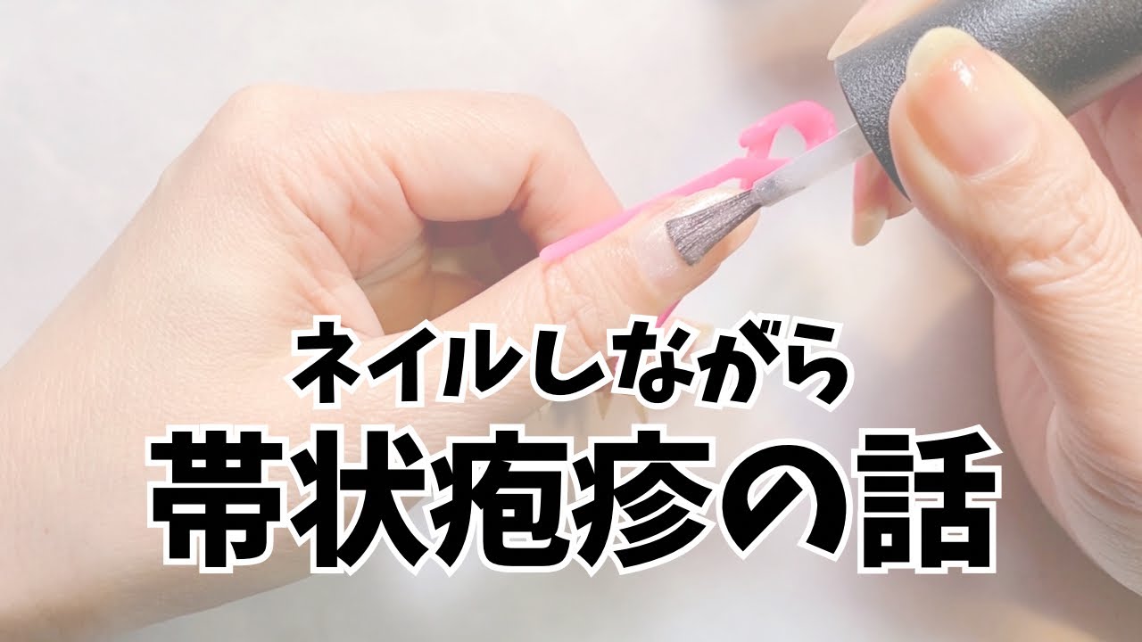 実は帯状疱疹になっていました。体験したこと語りながらネイル