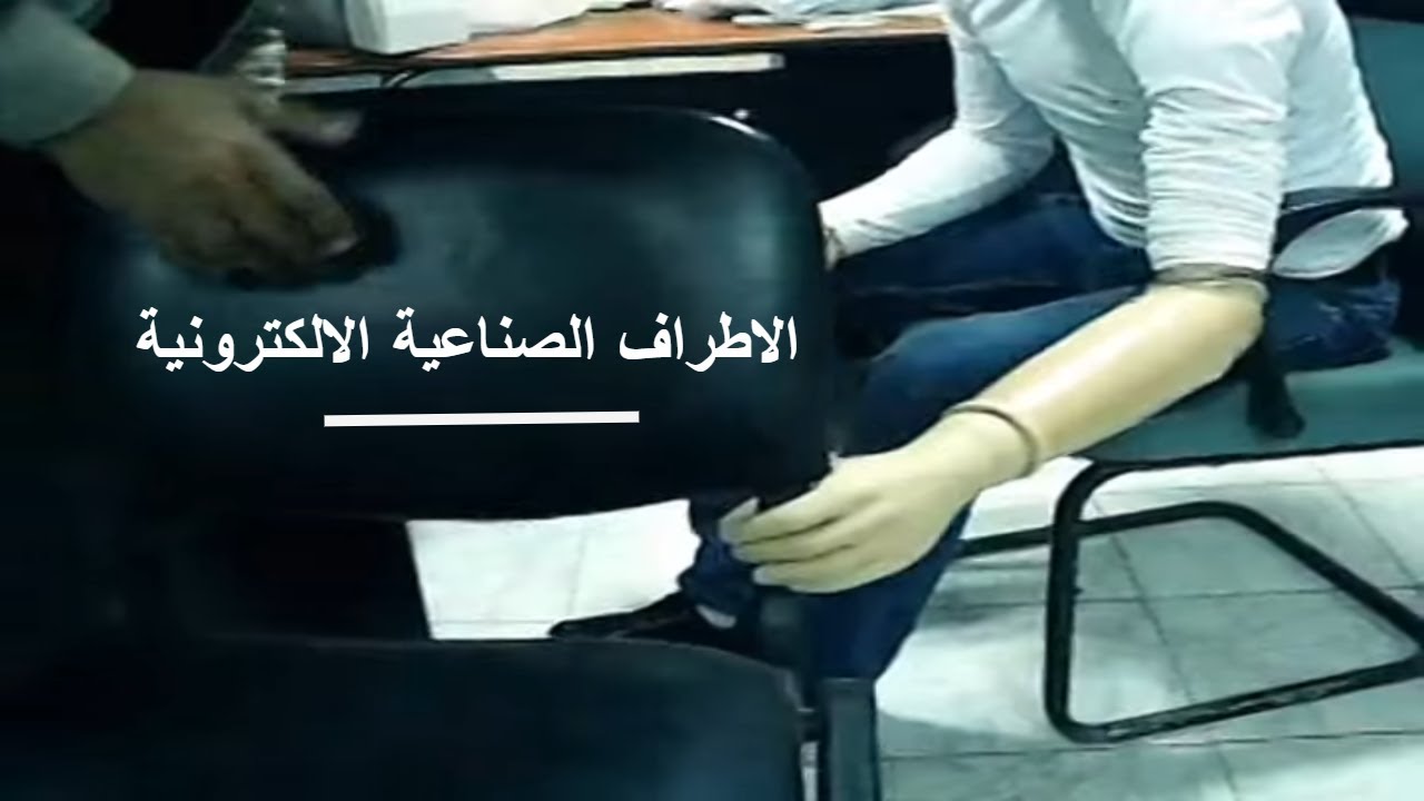 طرف صناعي تحت الكوع كف الكتروني أوتوبوك الماني - الاطراف الصناعية لليد - الفضل ميديكال 01094402330