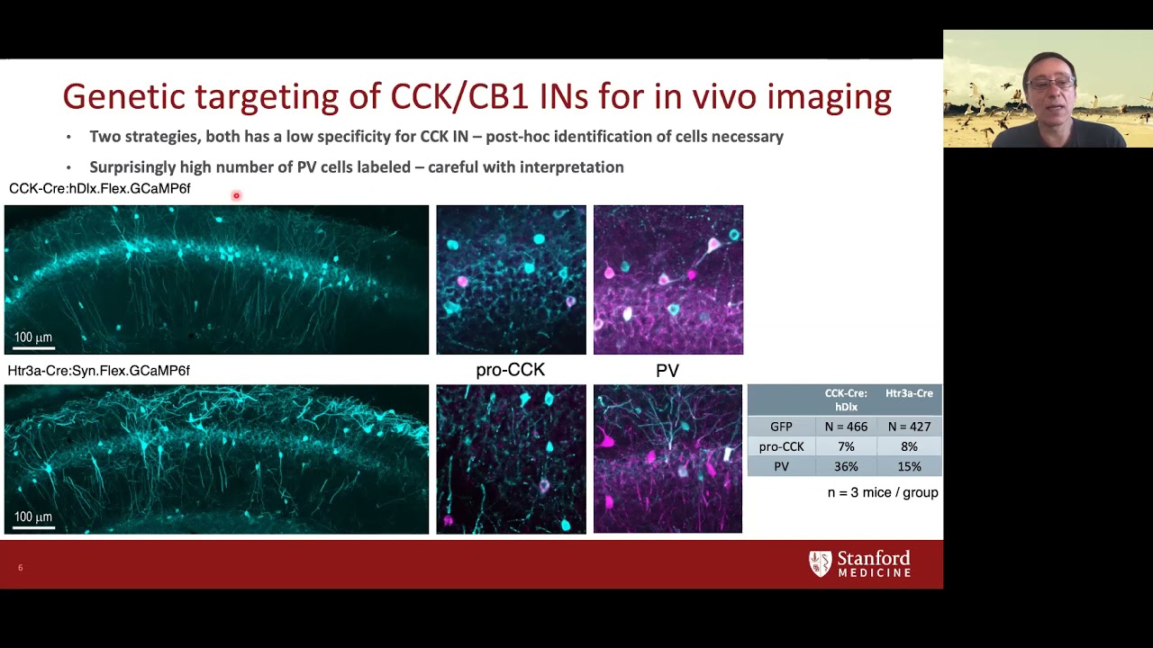 WWN Experimental Epilepsy-Ivan Soltesz: Organization and Control of Hippocampal Circuits in Epilepsy