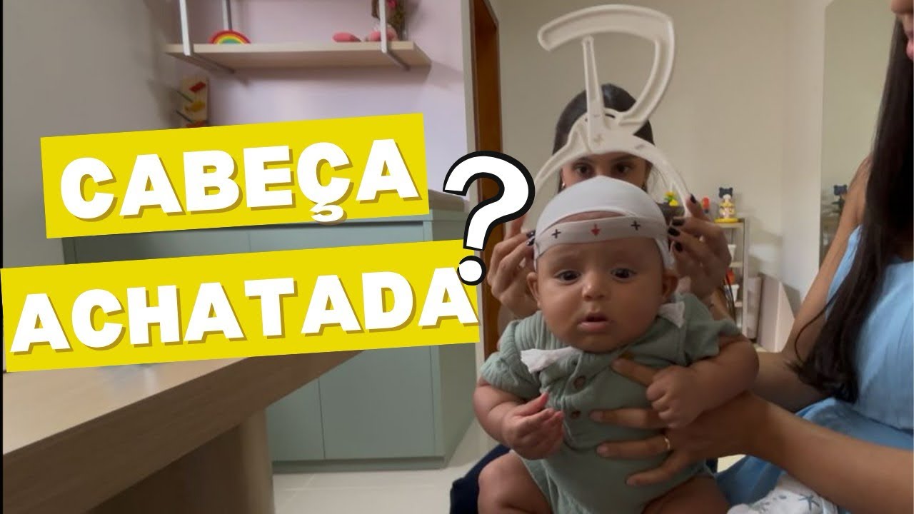 MATERNIDADE: COMO SABER SE O BEBÊ TEM CABEÇA ACHATADA? | PRIMEIRA CONSULTA DO PEDRO NA FISIOTERAPIA