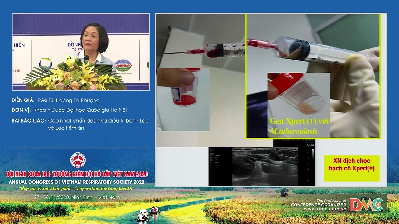 Cập nhật chẩn đoán và điều trị bệnh Lao và Lao tiềm ẩn