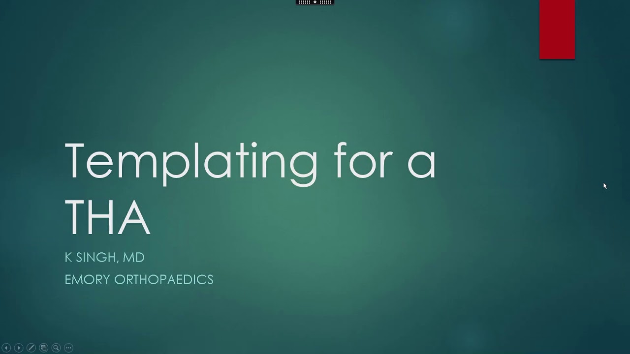 Templating