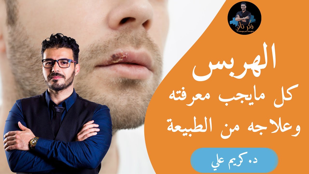 علاج الهربس الفموى وقرح الشفاه فى يوم واحد  ما الوقايه والعلاج الفعال