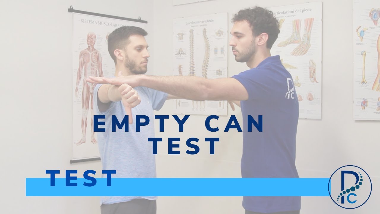 Sindrome da impingement subacromiale - Empty can test