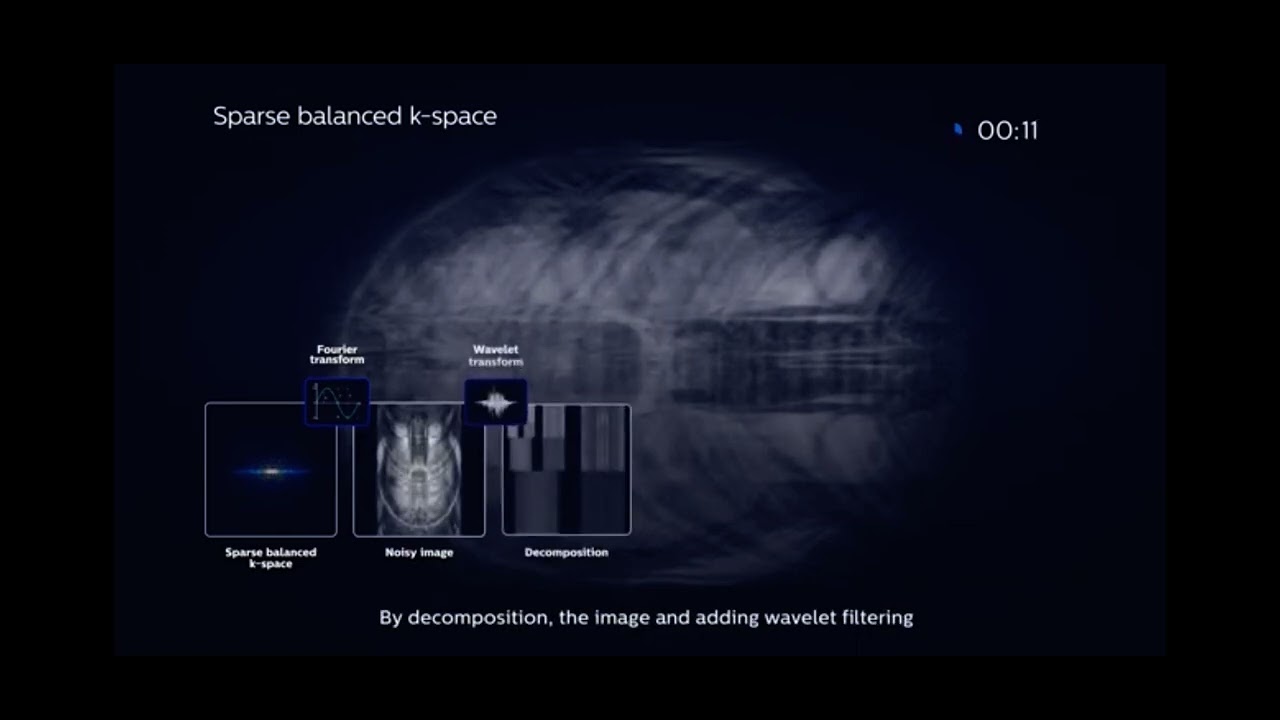 MRI - Compressed Sense- How does it work!!