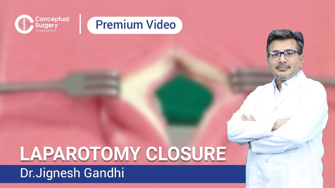 Laparotomy Closure Dr. Jignesh Gandhi