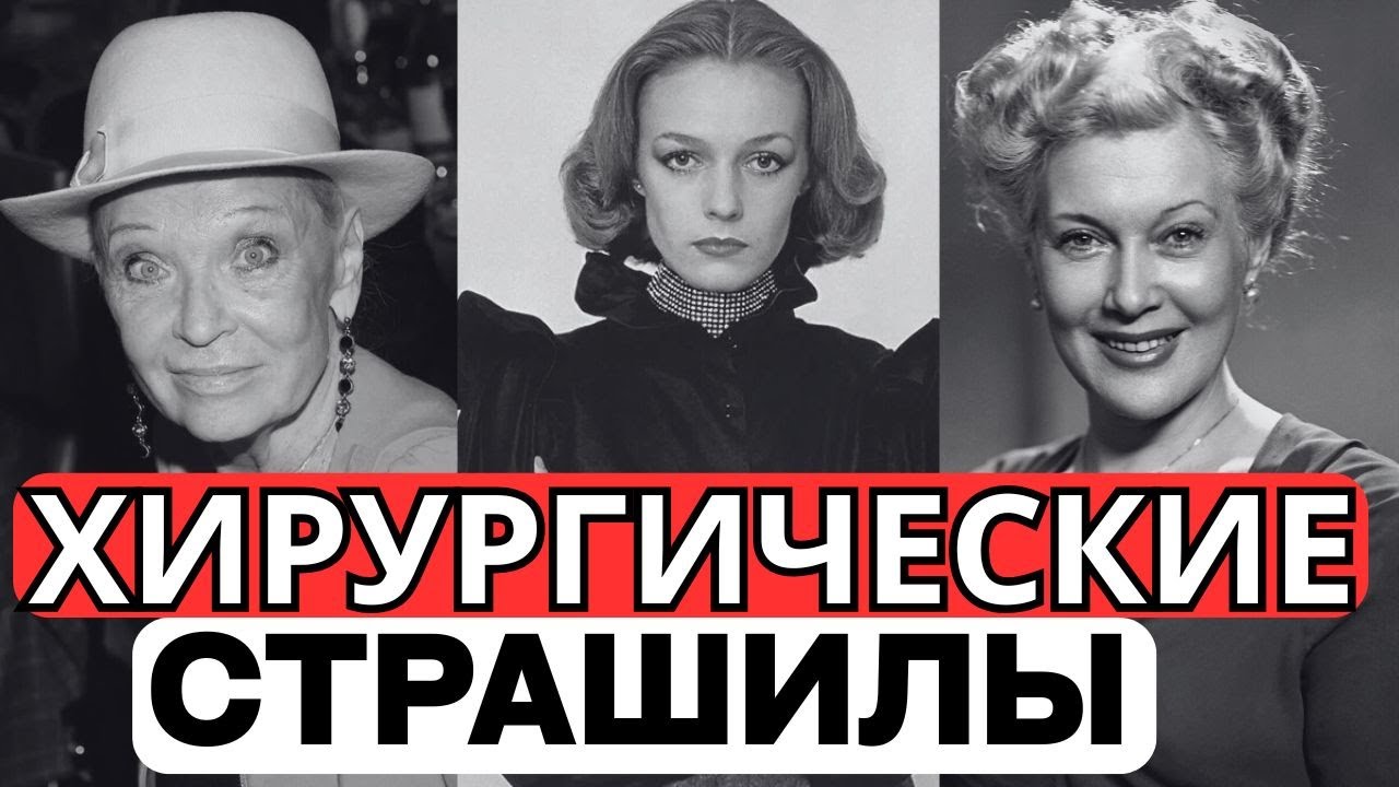 ИХ ИЗУРОДОВАЛИ: 10 актрис СССР, которых изуродовали подпольные пластические хирурги!