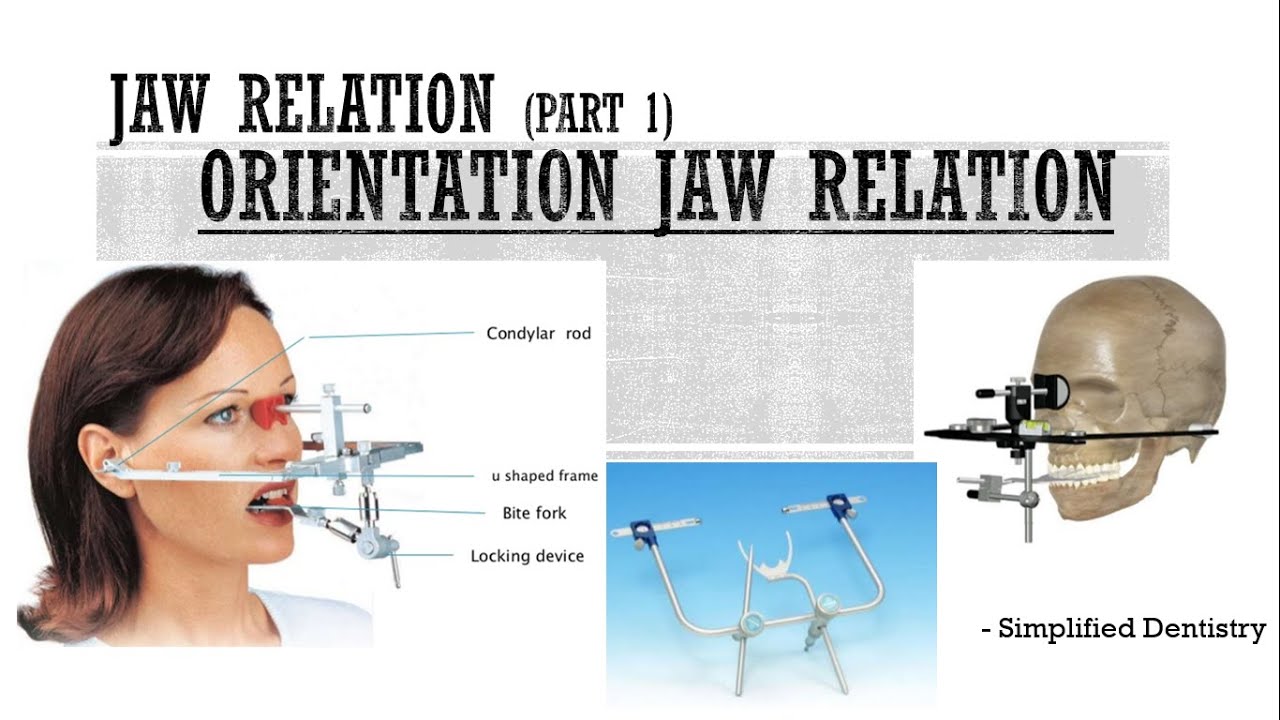 Orientation Jaw Relation | Facebow