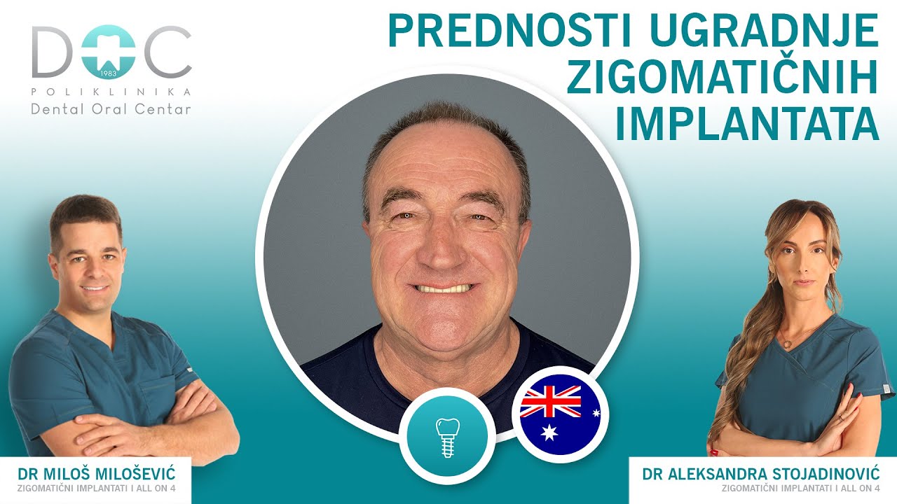 Prednosti zigomatičnih implantata - iskustvo pacijenta - dr Miloš Milošević