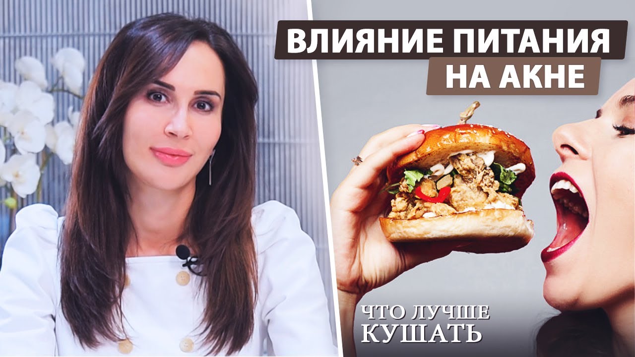Как питание влияет на акне?