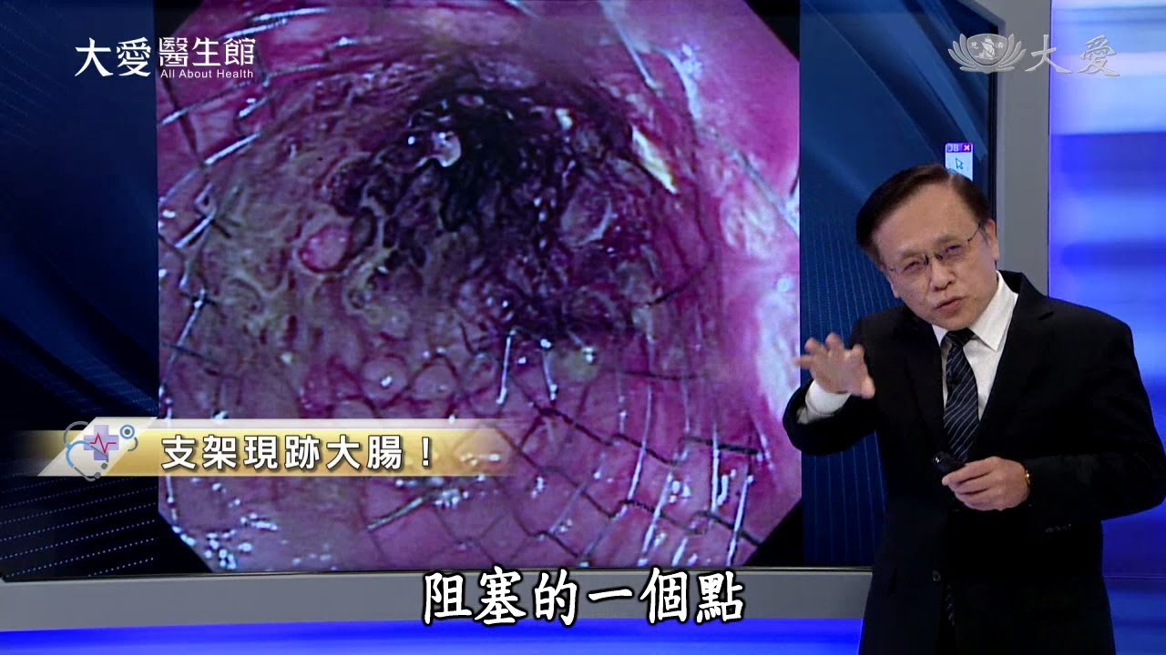 【大愛醫生館】20220412 - 支架現跡大腸！