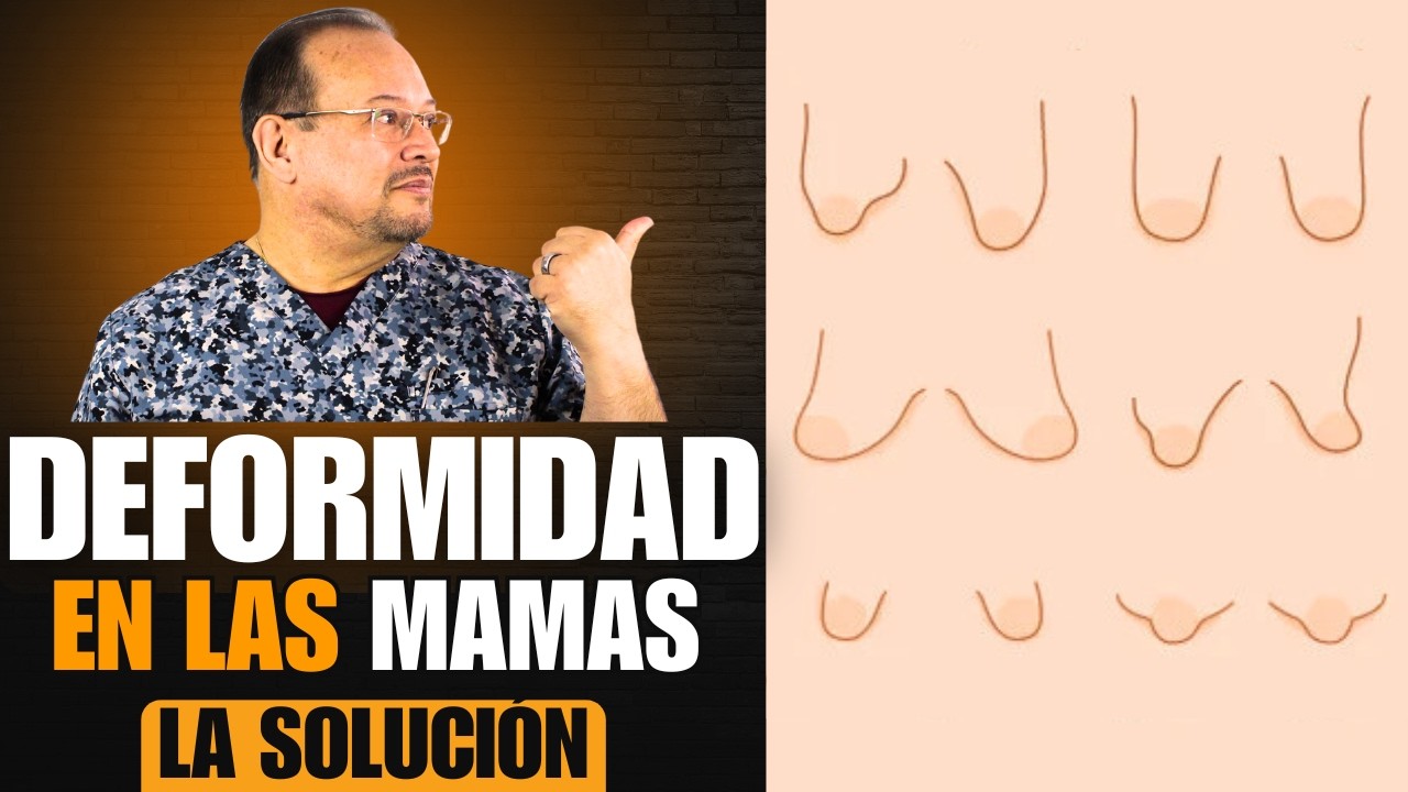 Terribles PROBLEMAS En Mamas 👙 En Snoopy, Tuberosa, Sinmastia, Atelia, Politelia, Macro y Microtelia