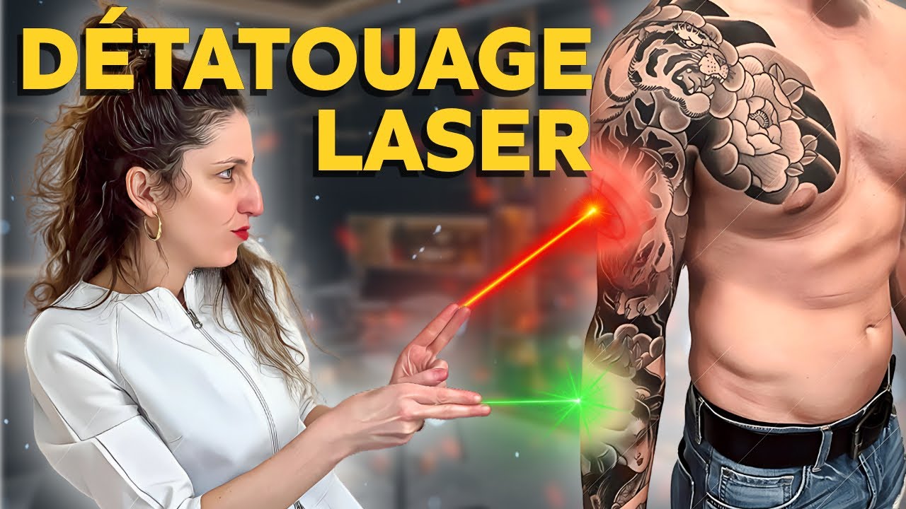 DÉTATOUAGE au laser : facile ou difficile à retirer ?