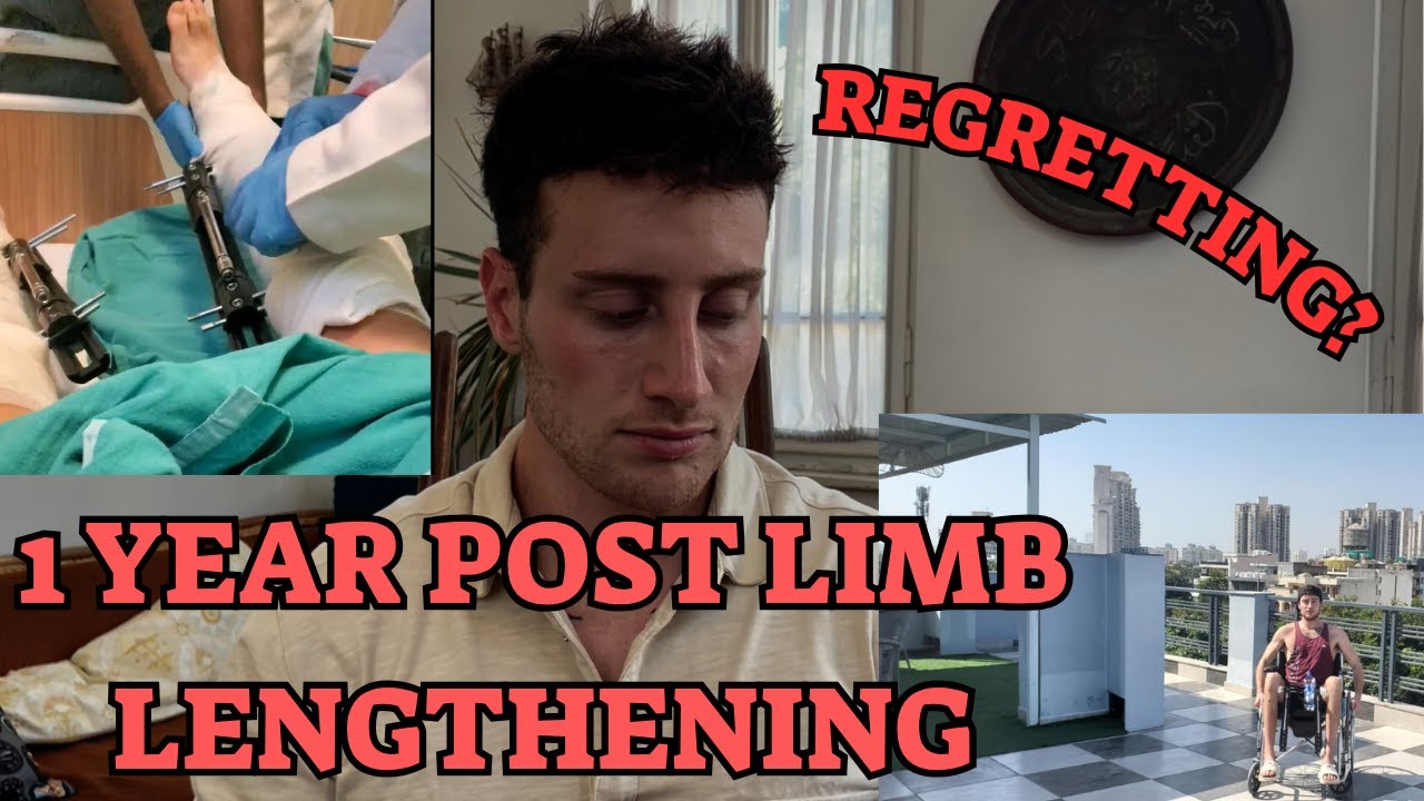 DO I REGRET GETTING LIMB LENGTHENING? (1 year later)