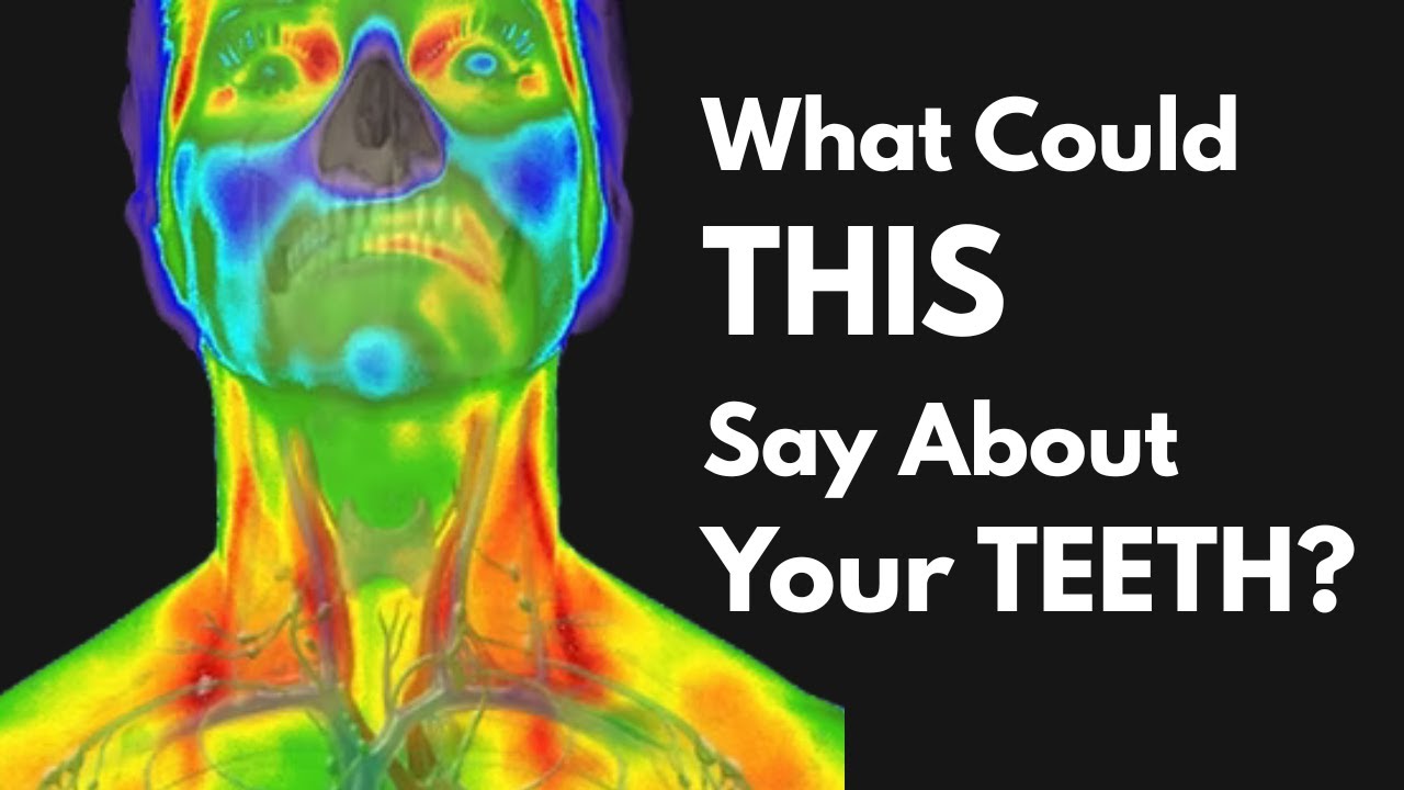 Could Thermal Imaging Boost Case Acceptance Rates? | Interview with Kane Thermal Imaging CEO