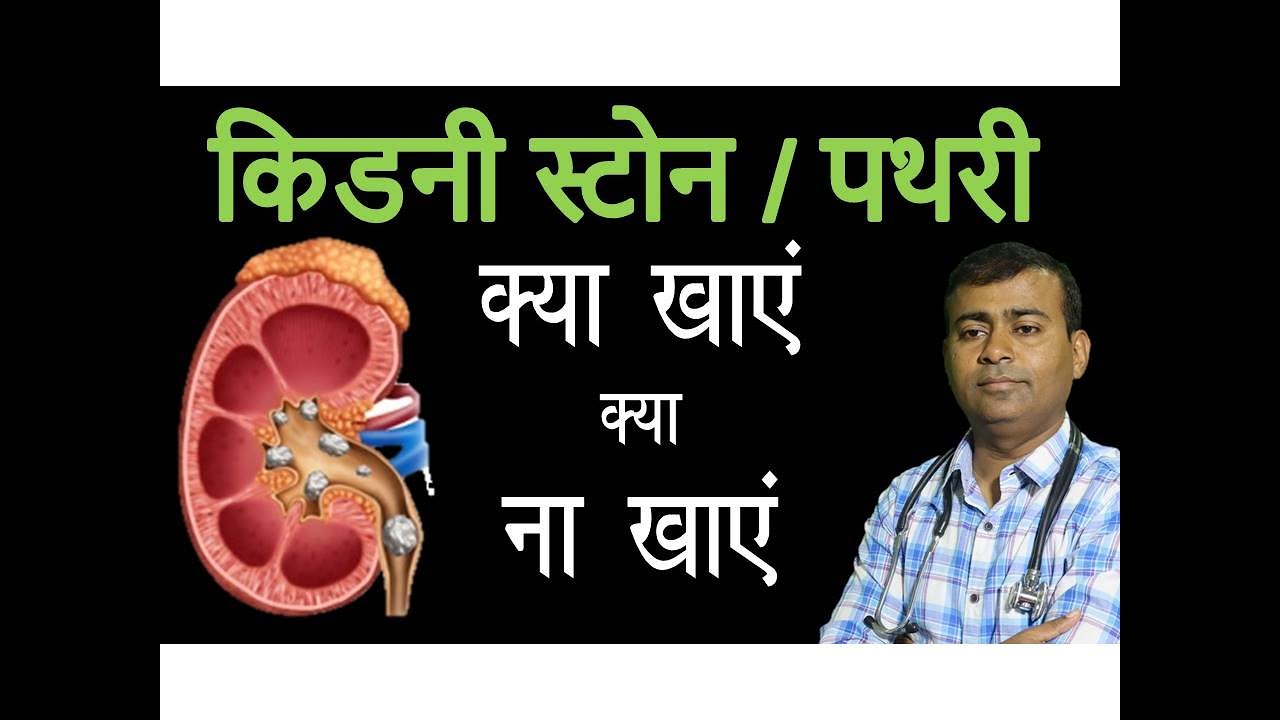 किडनी स्टोन / पथरी के परहेज़