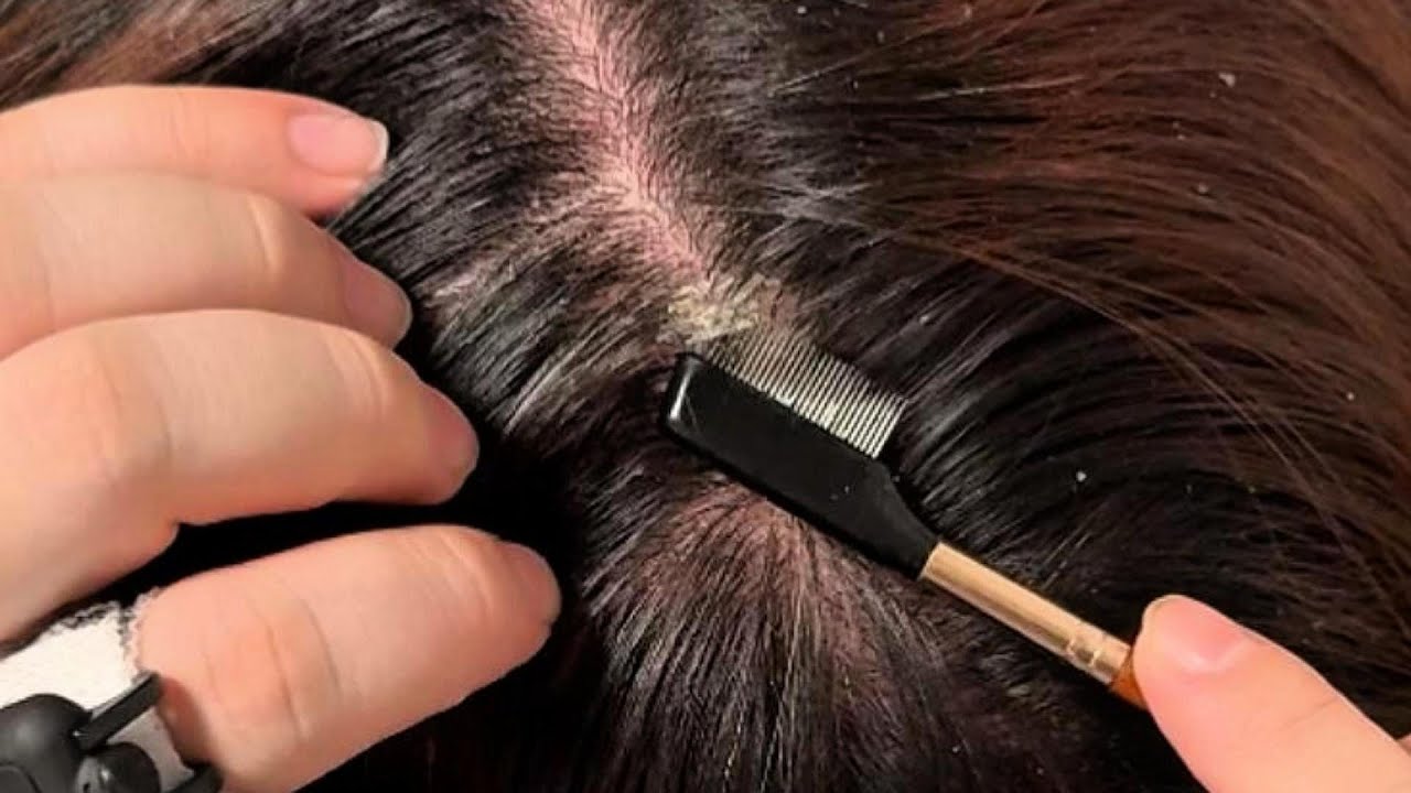 JOJO’s ASMR Scalp Care — Consistent Small-Comb Spacing for Calm Reset | No Talking
