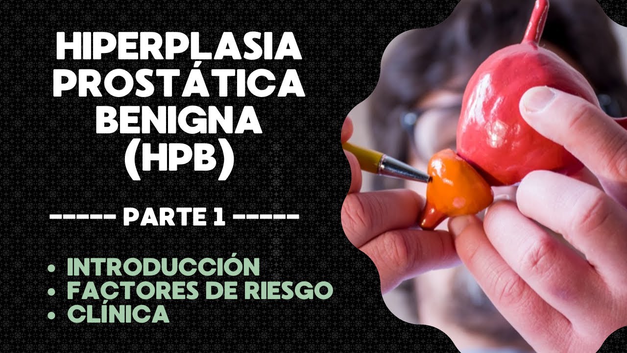 Hiperplasia prostática benigna (HPB) | Todo lo que tienes que saber | PARTE 1