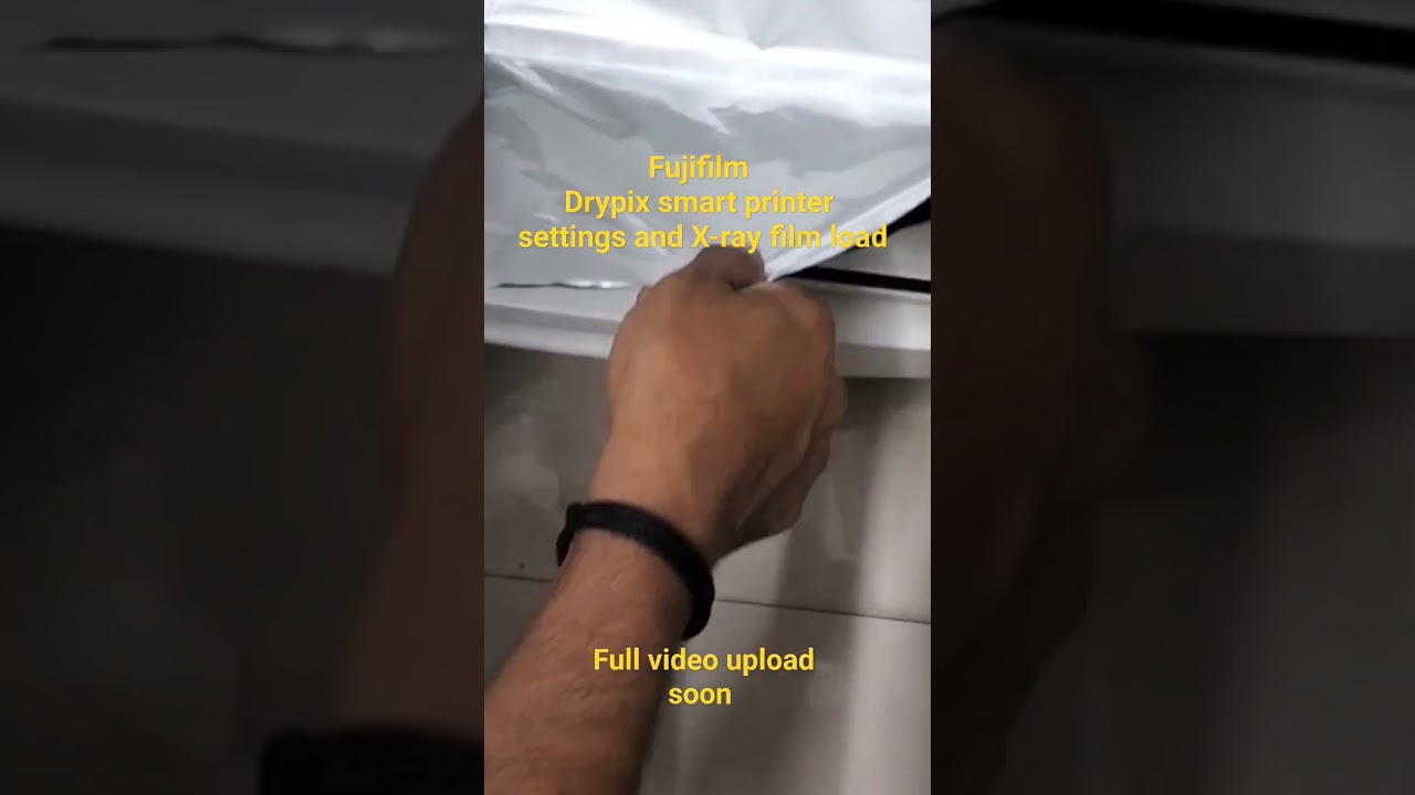 How to load x-ray film in Drypix smart printer in hindi । Fujifim printer all settings solution..