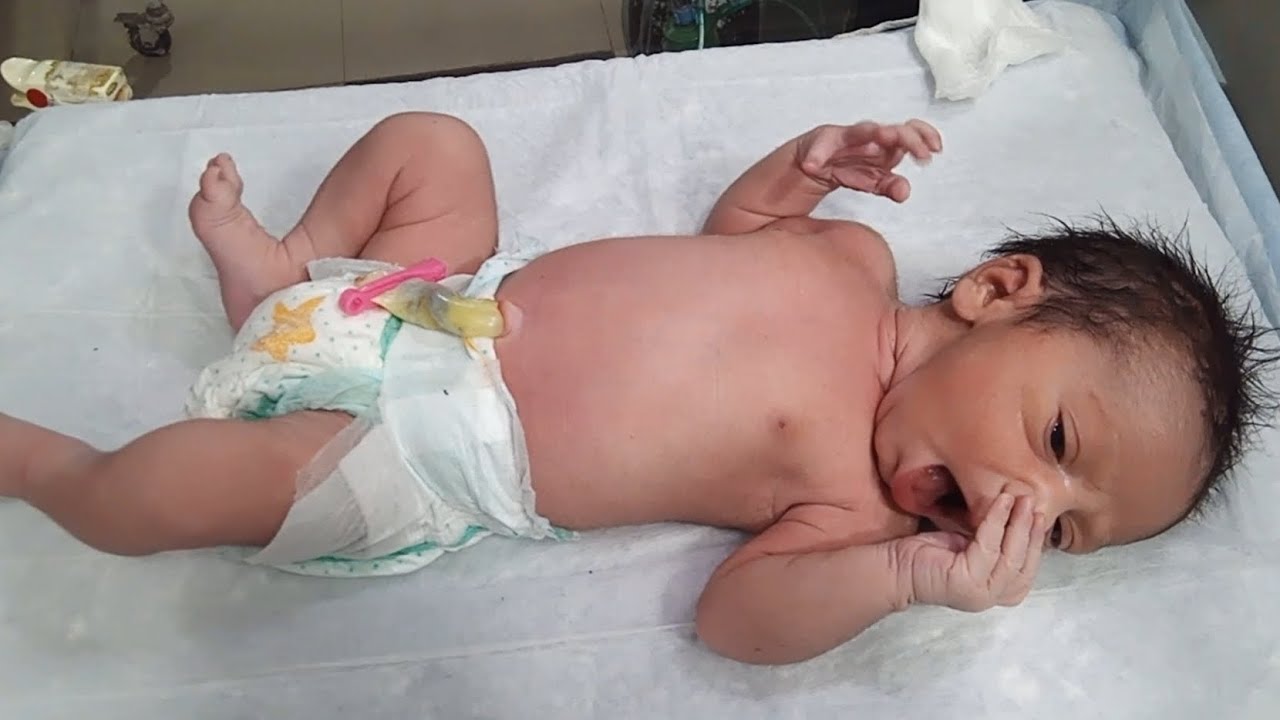 Newborn Baby Warmer Care | Feeding Trial & Physiotherapy Routine in NICU